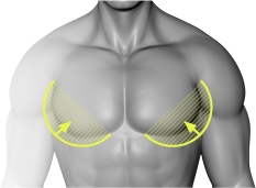 女性化乳房とは
