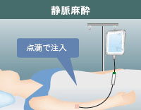 静脈麻酔とは