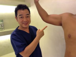 脂肪吸引1年後の身体