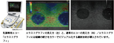 女性化乳房の種類を見分けるエコー