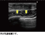 真性女性化乳房治療の実際を、医師目線で完全レポート