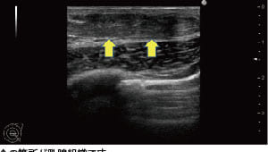 真性女性化乳房治療の実際を、医師目線で完全レポート