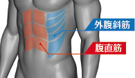 お腹の脂肪吸引でキーになる、腹直筋と外腹斜筋のイメージ