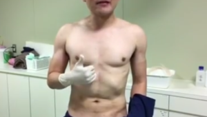 男性の脂肪吸引。その手術直後をご紹介