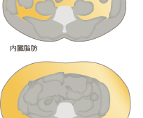 お腹の脂肪吸引で見違える姿に変身した、ある男性ゲスト