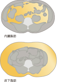 お腹の脂肪吸引で見違える姿に変身した、ある男性ゲスト