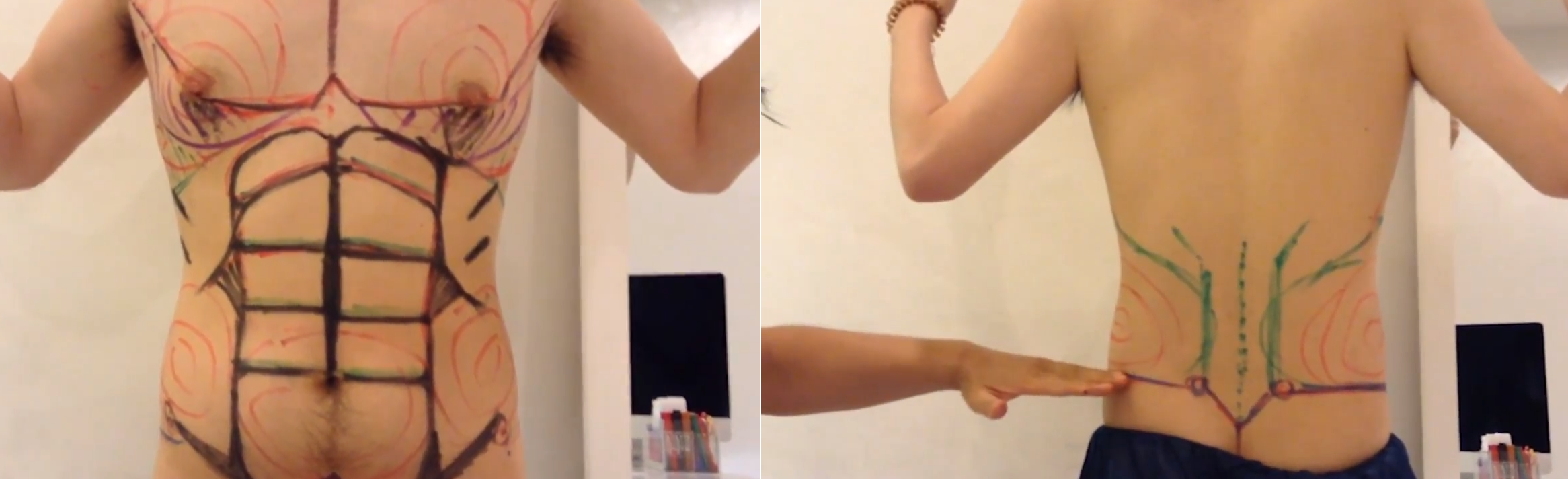 脂肪吸引前のマーキング（20代男性）