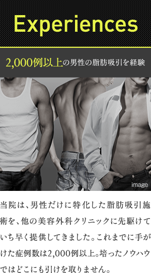 Experiences | 2,000例以上の男性の脂肪吸引を経験 | 当院は、男性だけに特化した脂肪吸引施術を、他の美容外科クリニックに先駆けていち早く提供してきました。これまでに手がけた症例数は2,000例以上。培ったノウハウではどこにも引けを取りません。