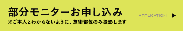 部分モニターお申し込み