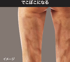 でこぼこになる
