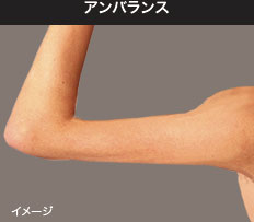 アンバランス
