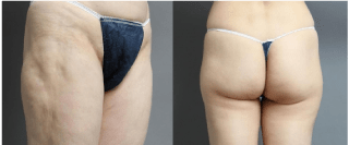 失敗修正治療も積極的に受け入れる