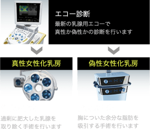 女性化乳房外来の治療の流れ