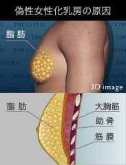 胸に皮下脂肪が蓄積することで、胸が膨らみます。