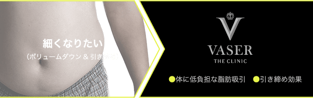 まずは皮下脂肪を無くしたい方には「ベイザー脂肪吸引」がおすすめ
