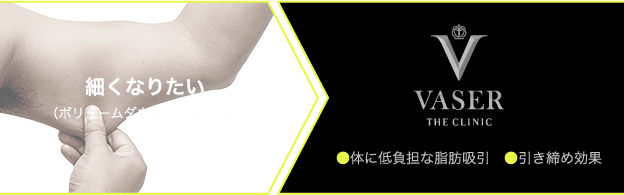 とにかく細くなりたい方には通常のベイザー脂肪吸引がおすすめ
